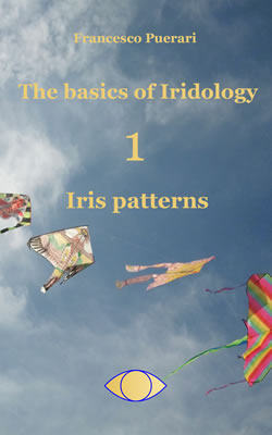 The-Basics-of-Iridology-Iris-patterns